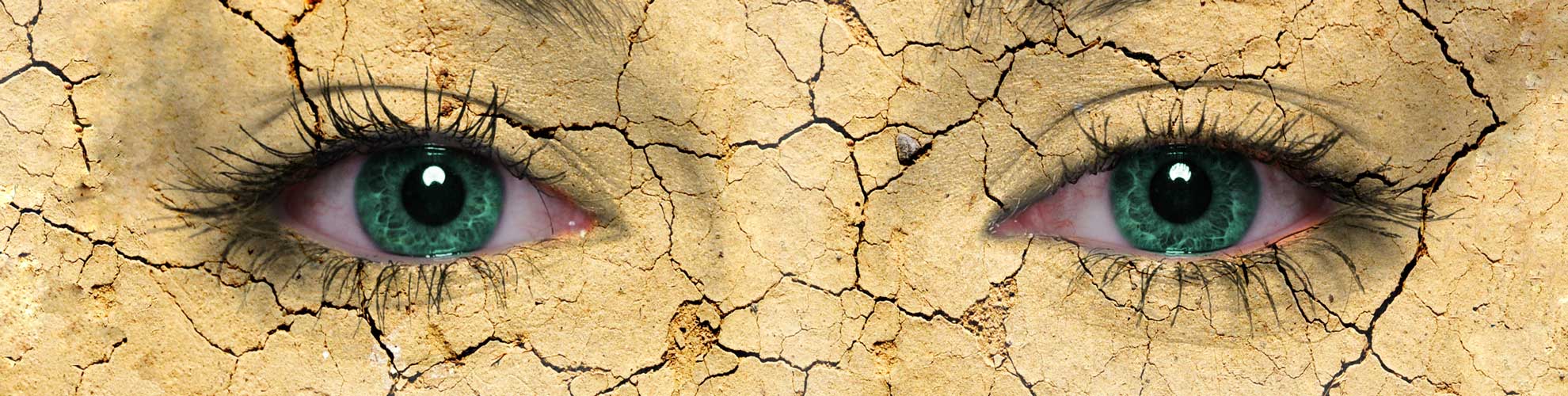 dry eye syndrome